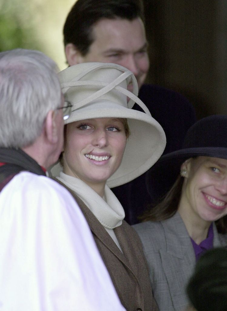 Zara Phillips sports facial injuries after a car accident in 2000