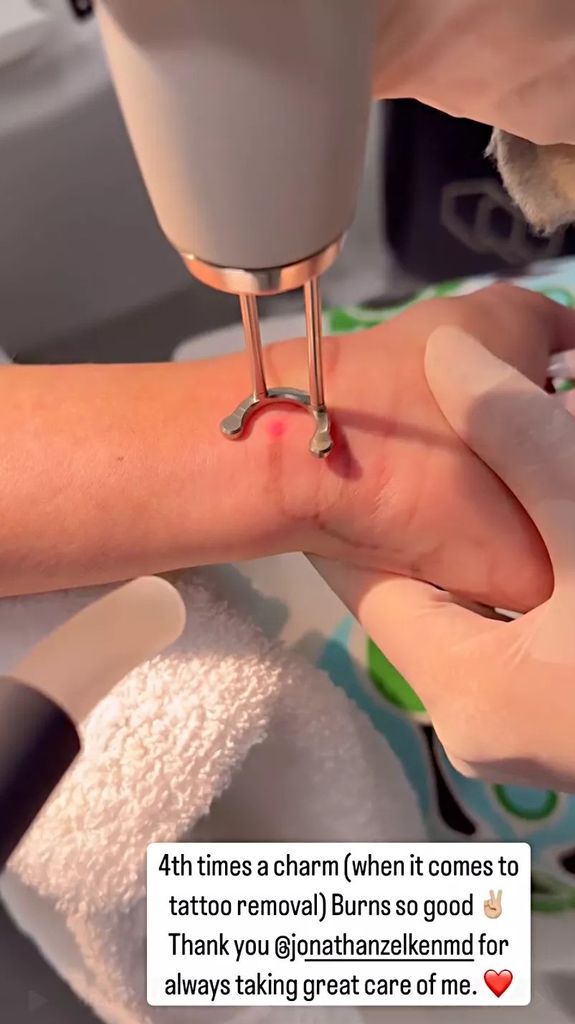 christina haack removing infinity tattoo