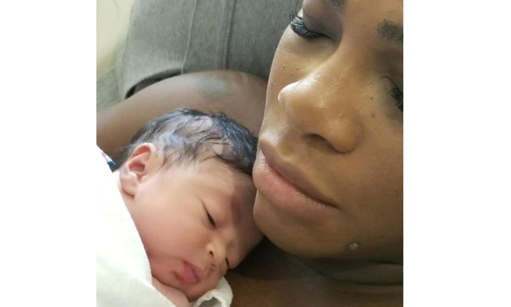 SERENA WILLIAMS WELCOMES BABY GIRL