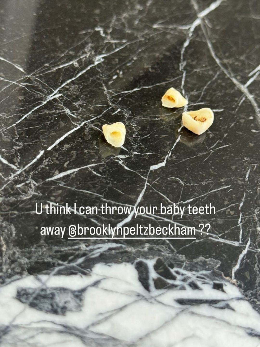 Victoria Beckham's son Brooklyn's baby teeth on a black counter