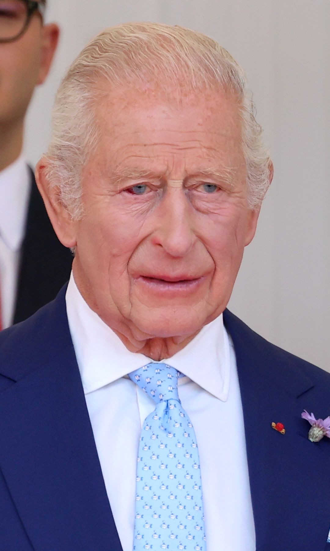 King Charles in a blue suit, there is a burst blood vessel in his left eye