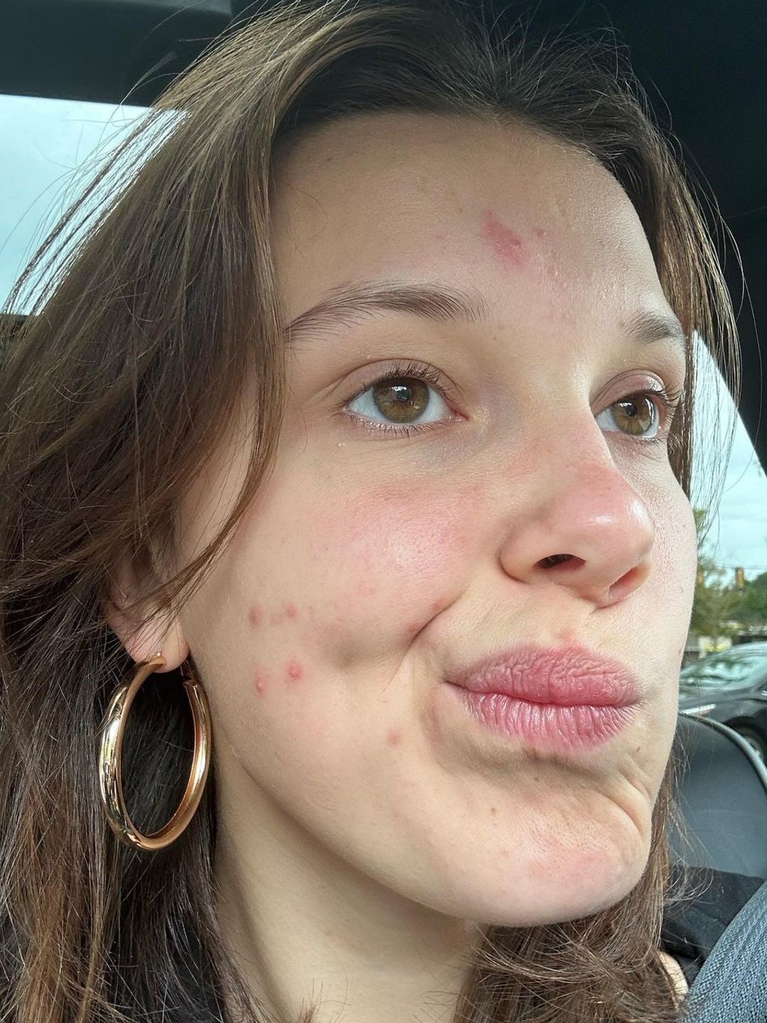 Millie shared the refreshingly candid post on her Instagram