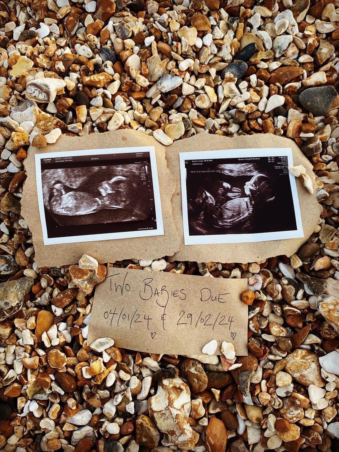 Kerry and Emily's baby scans