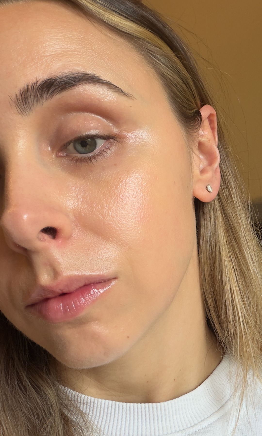 Emma après avoir utilisé ses sucettes cutanées coréennes