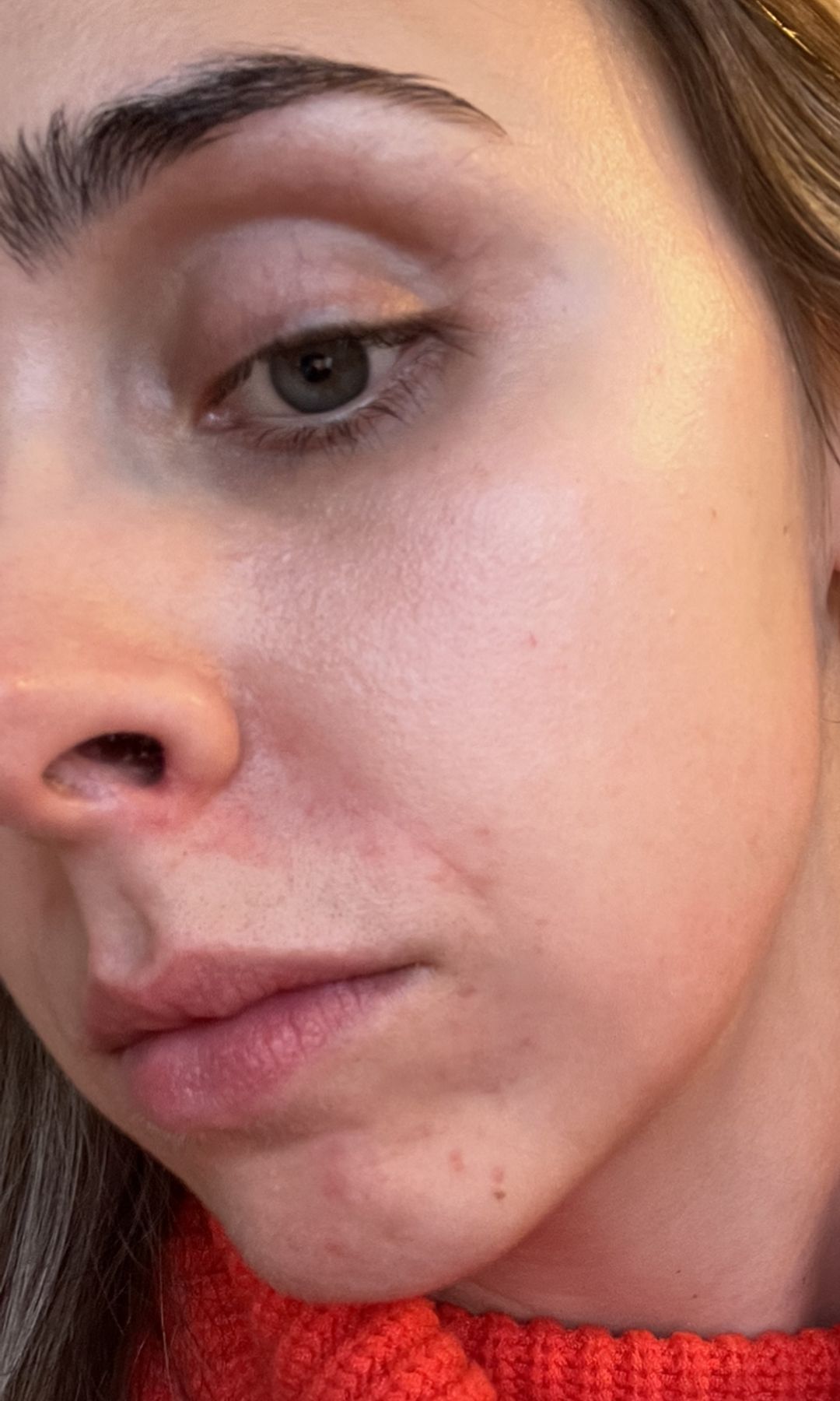 Emma avant de découvrir sa routine de soin coréenne