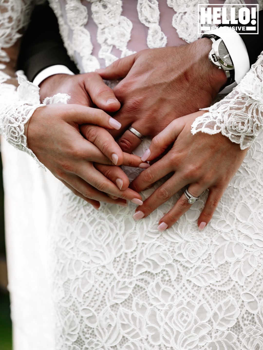 Amelia Spencer and Greg Mallett's wedding rings against her dress