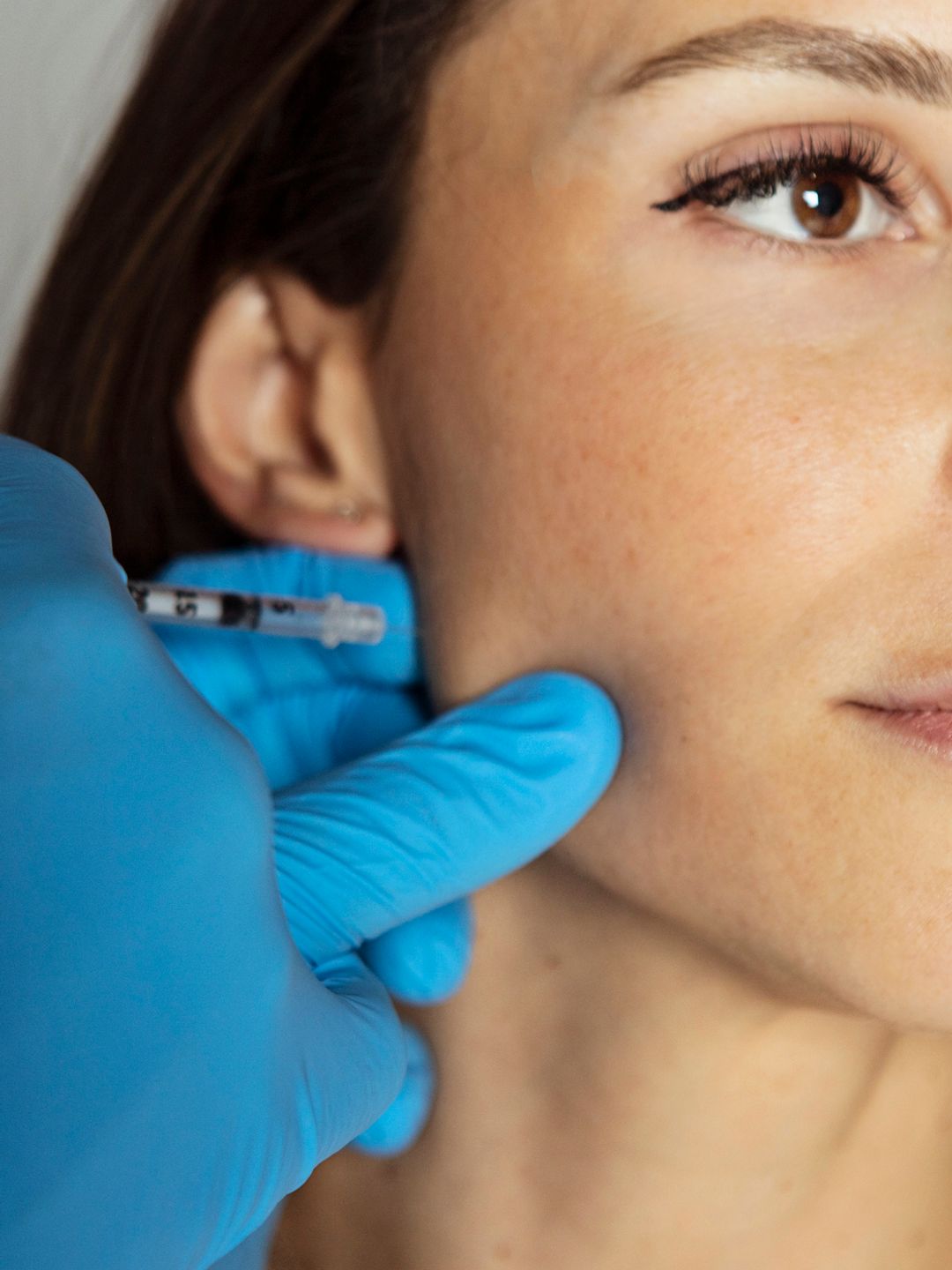 Masseter Botox can last from four to six months