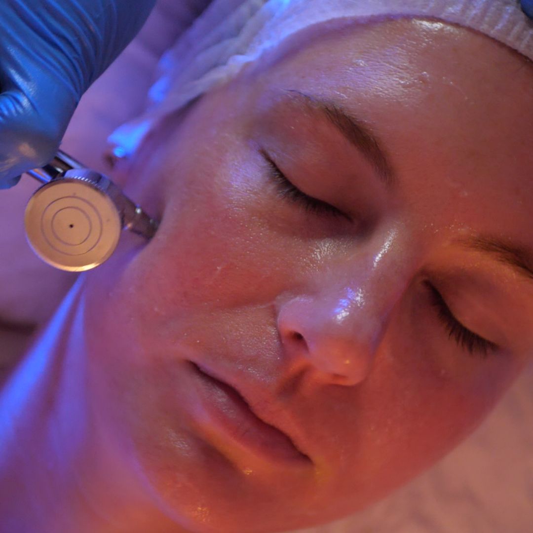 montrose facial close up of glass skin facial 