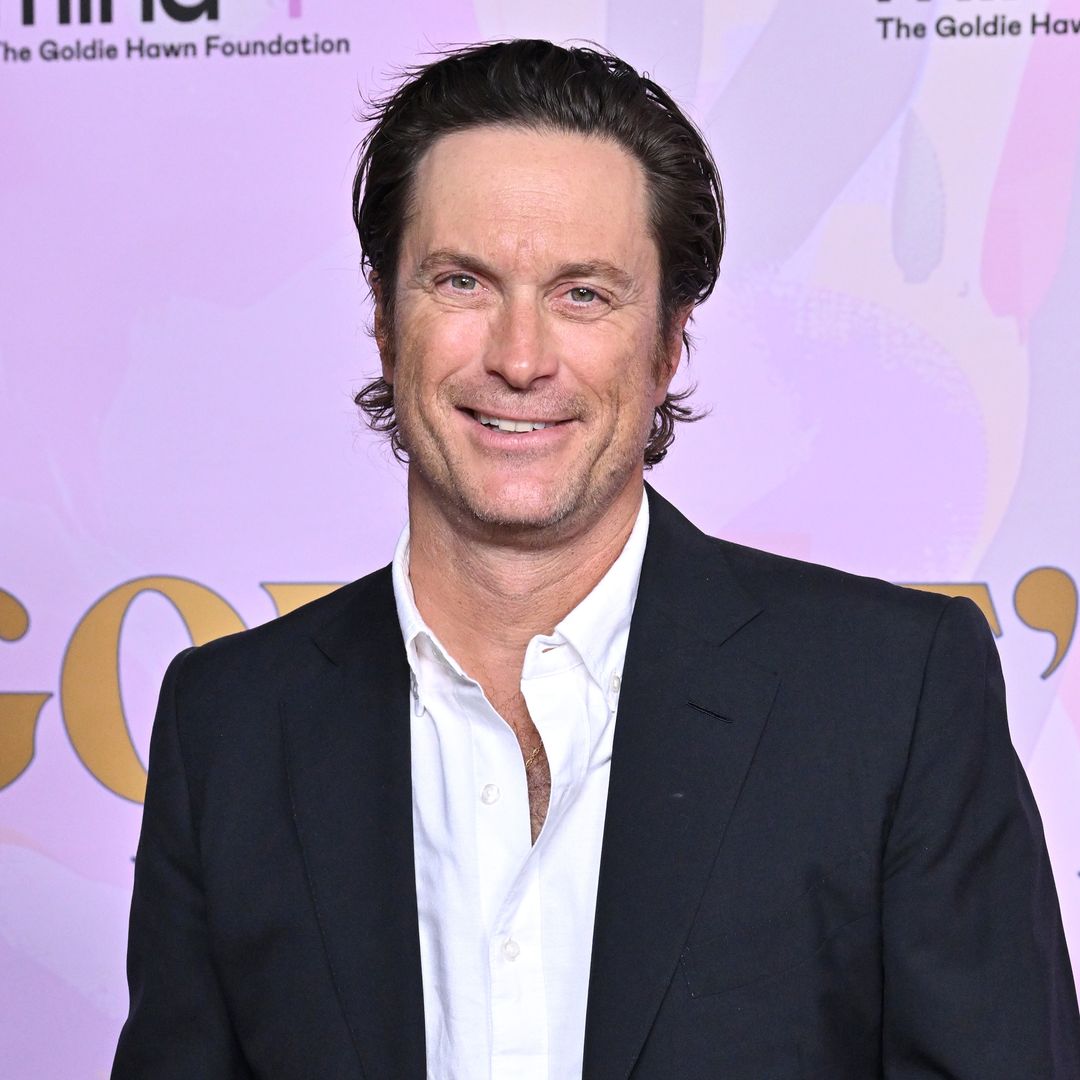Oliver Hudson leaves fans with a lot to say as he teases 'transformation' — watch