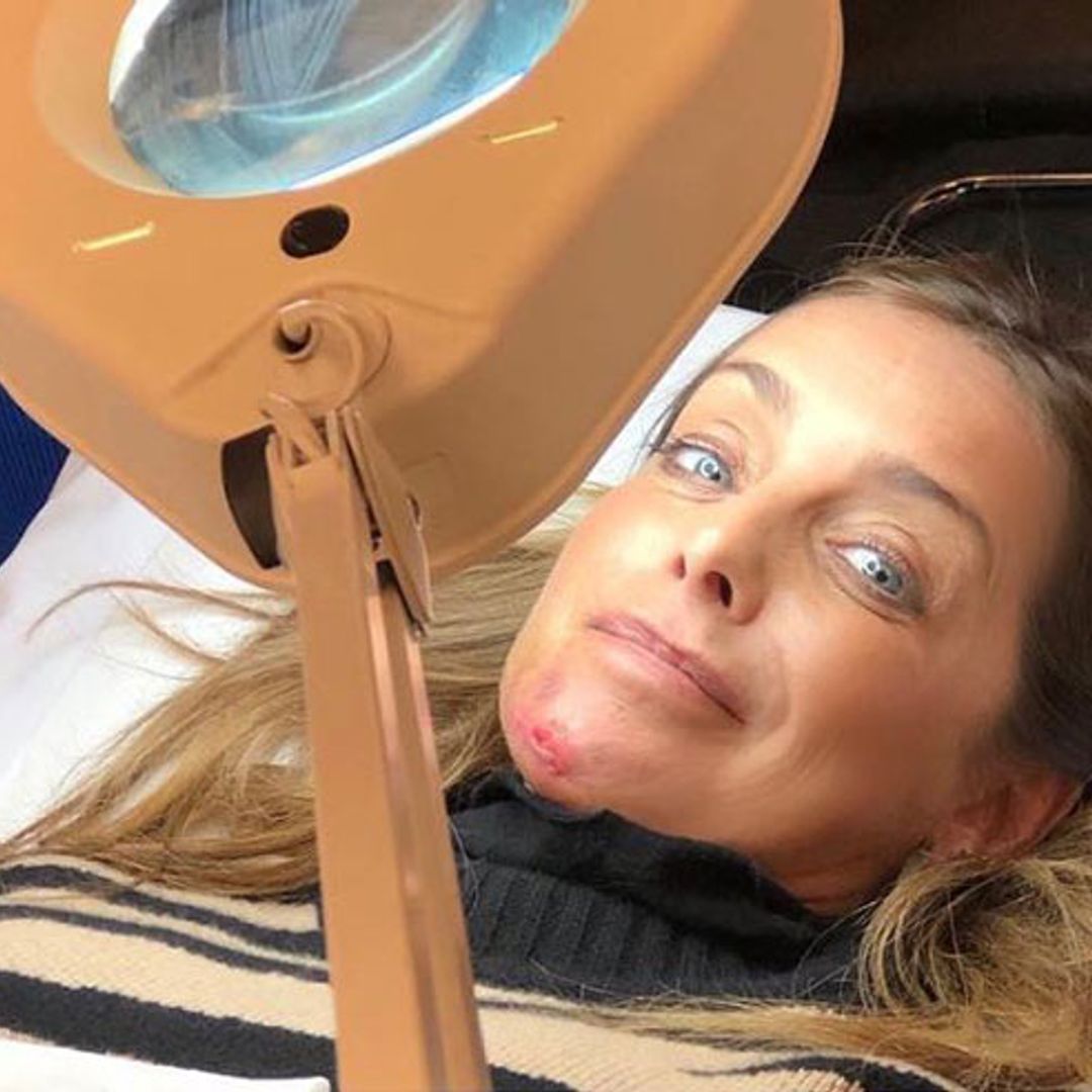 Louise Redknapp releases heartbreaking statement following horrific accident