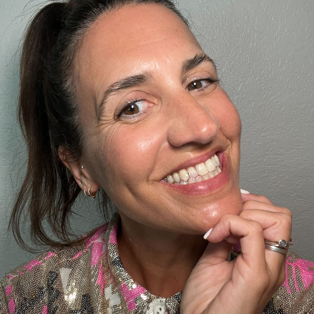 People keep telling me to 'fix' my face at 49