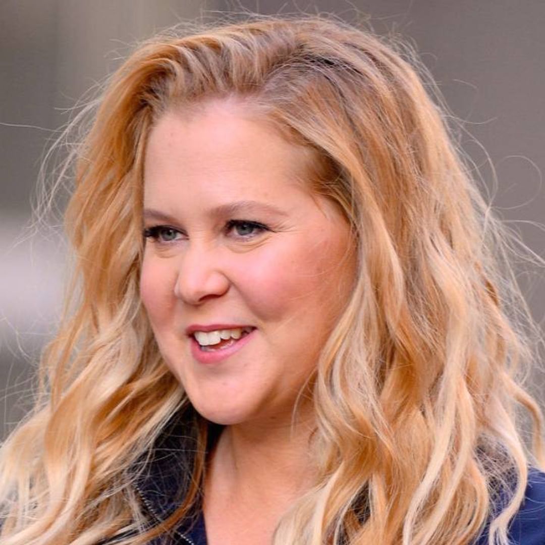 Amy Schumer shares results of liposuction after unexpected decision