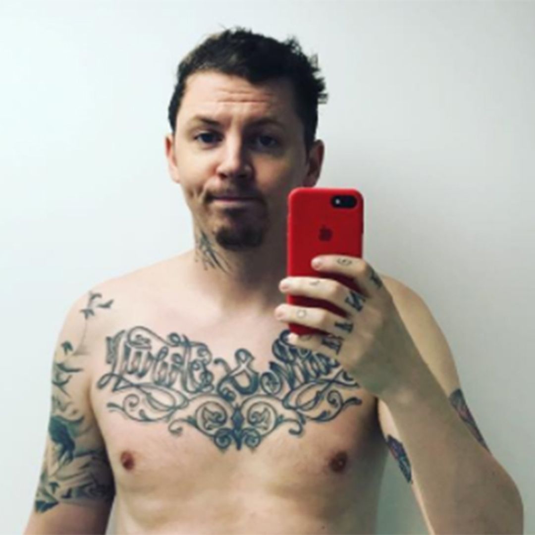 Professor Green posts shirtless photo after 'surgery gone wrong'