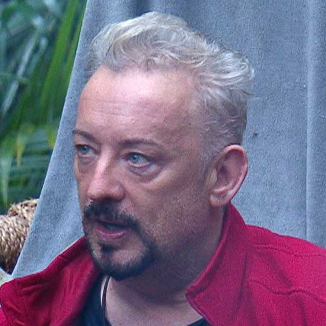 I'm a Celebrity star Boy George's hair loss surgery: before and after