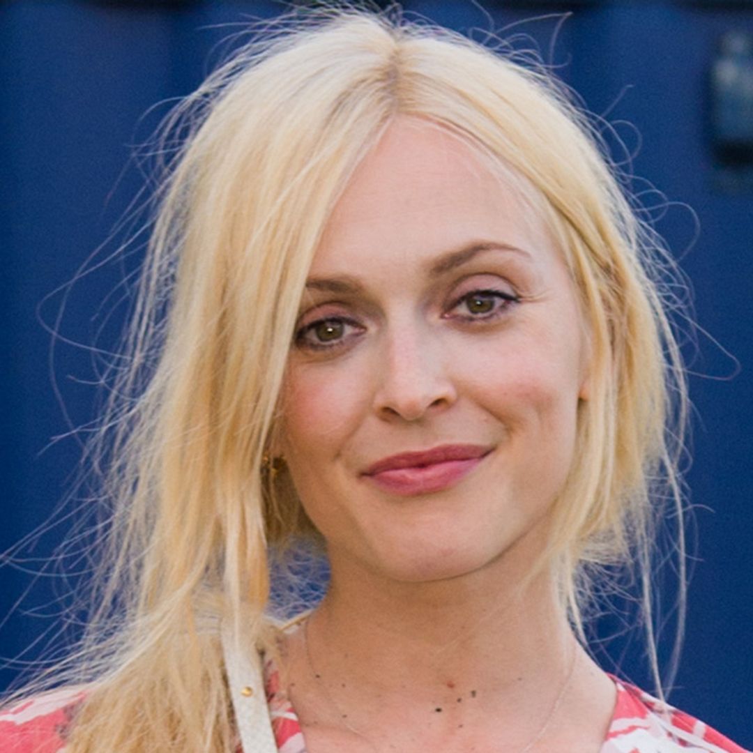 Fearne Cotton shares photo of painful head injury after home accident