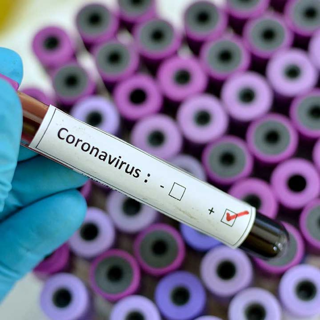 Doctor who overcame coronavirus reveals what symptoms are really like over three-week period