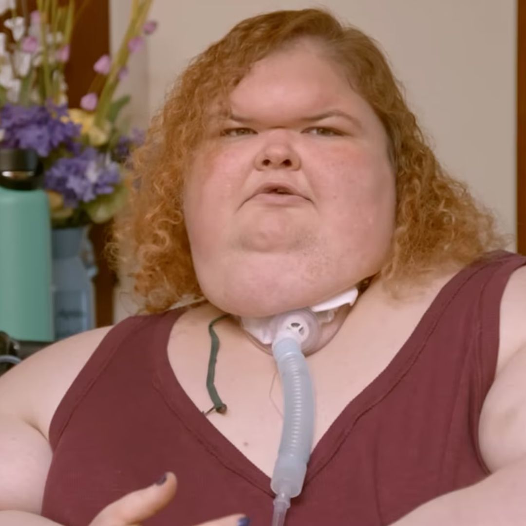 Tammy Slaton's incredible before and after skin removal surgery unveiled