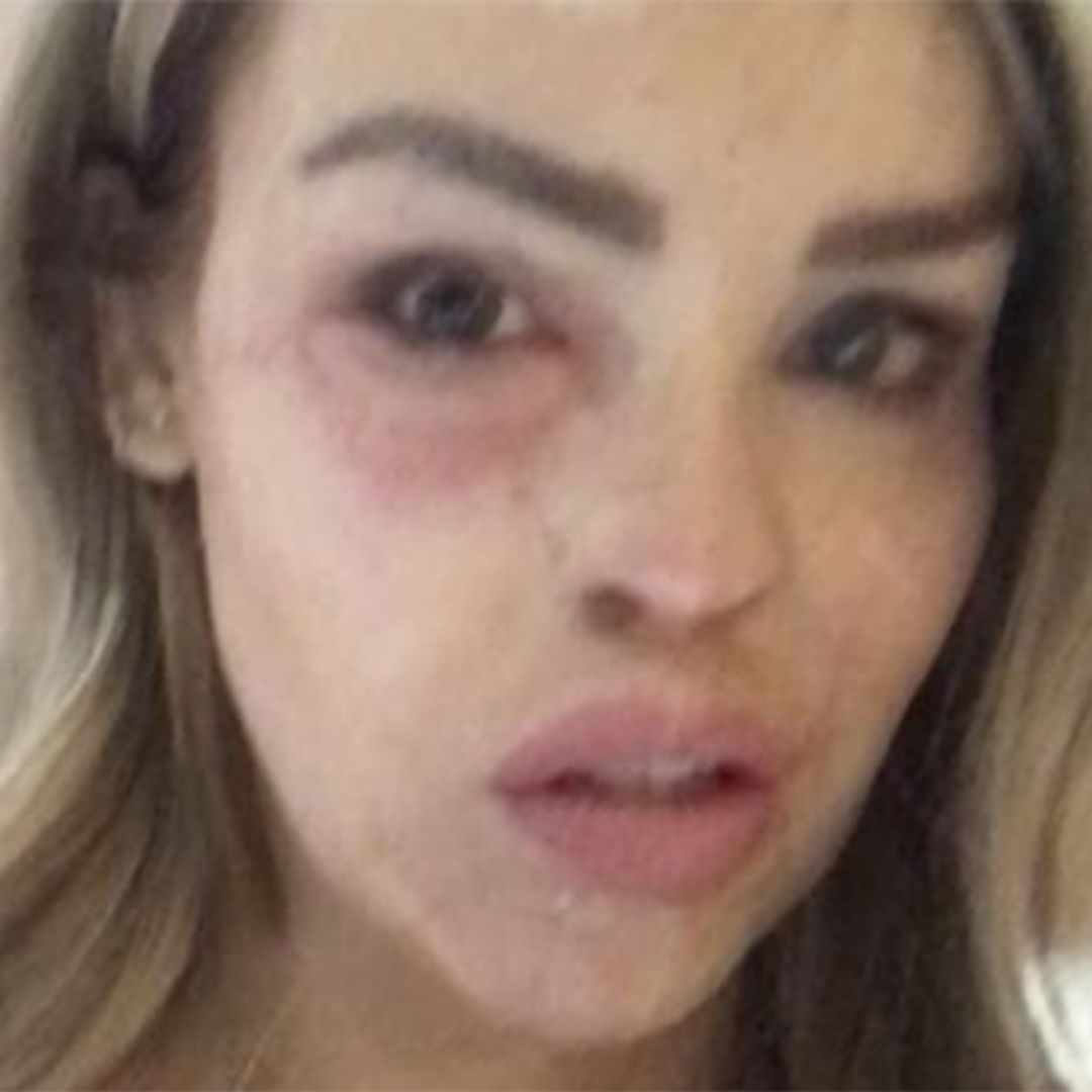 Katie Piper rushed to hospital on daughter Belle's 3rd birthday