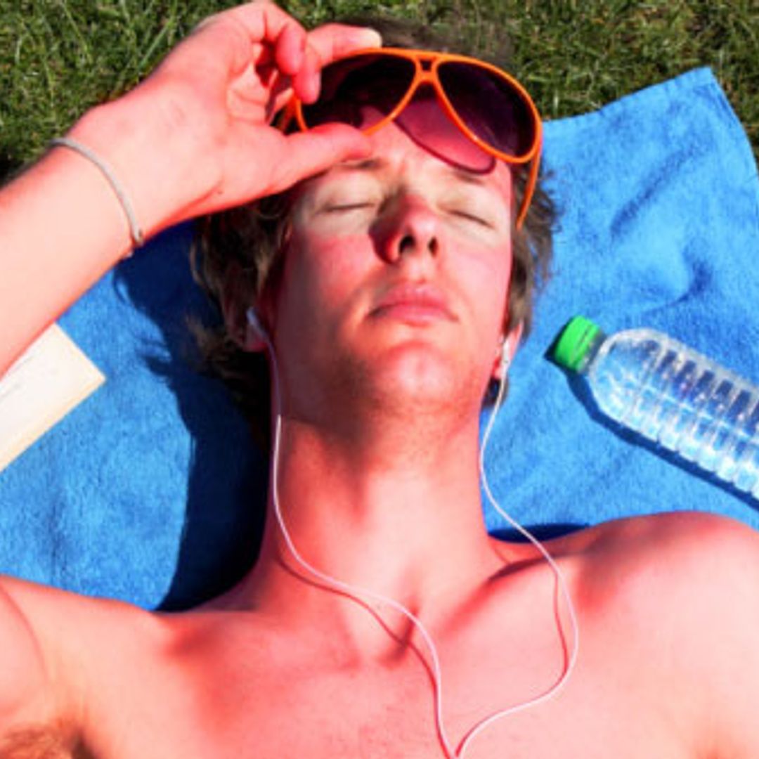 What to do about sunburn