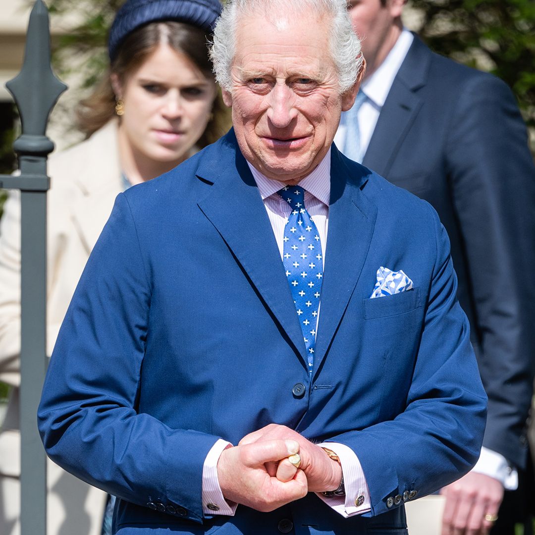 Why does King Charles III have swollen fingers?