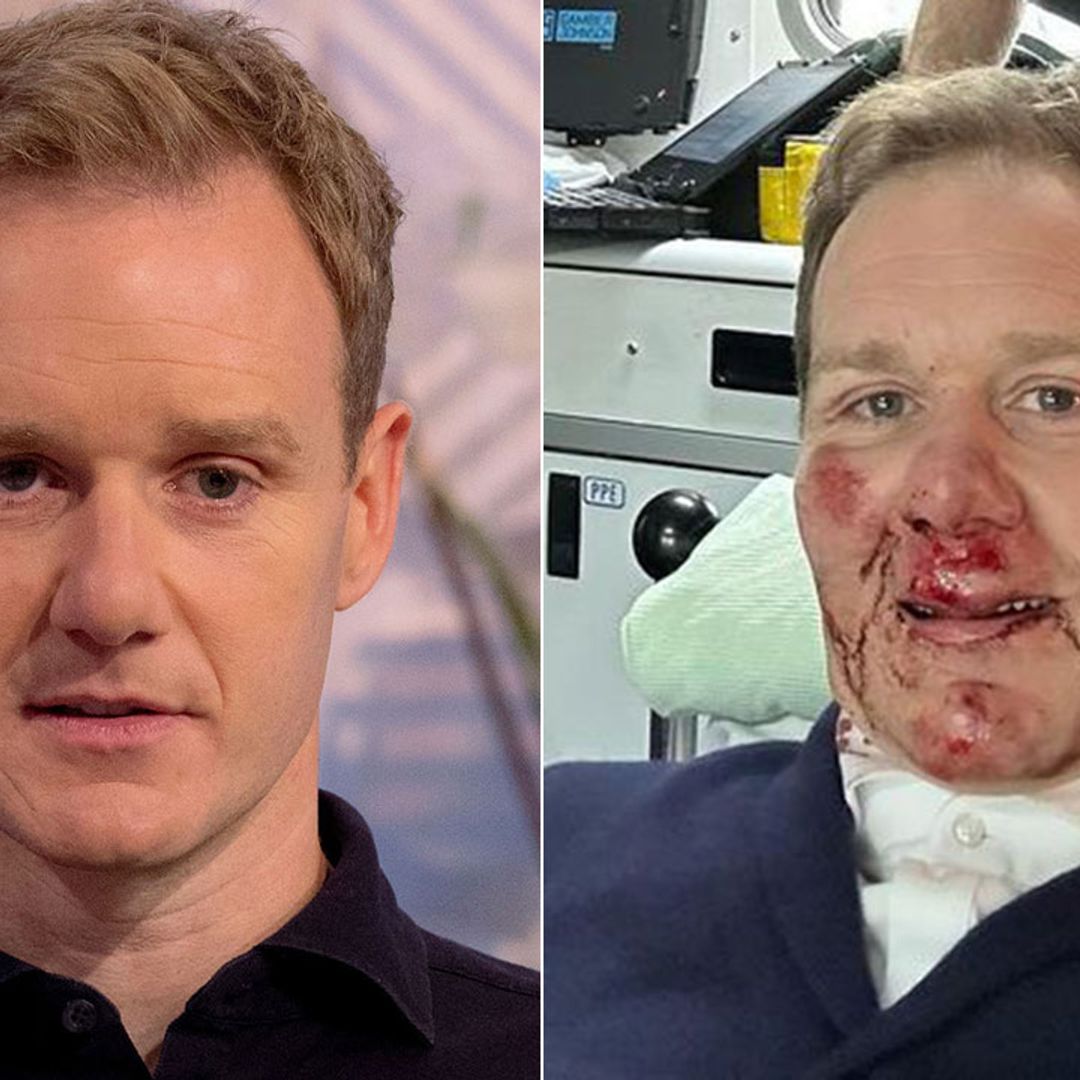 Dan Walker 'glad to be alive' after accident horror leaves him covered in blood
