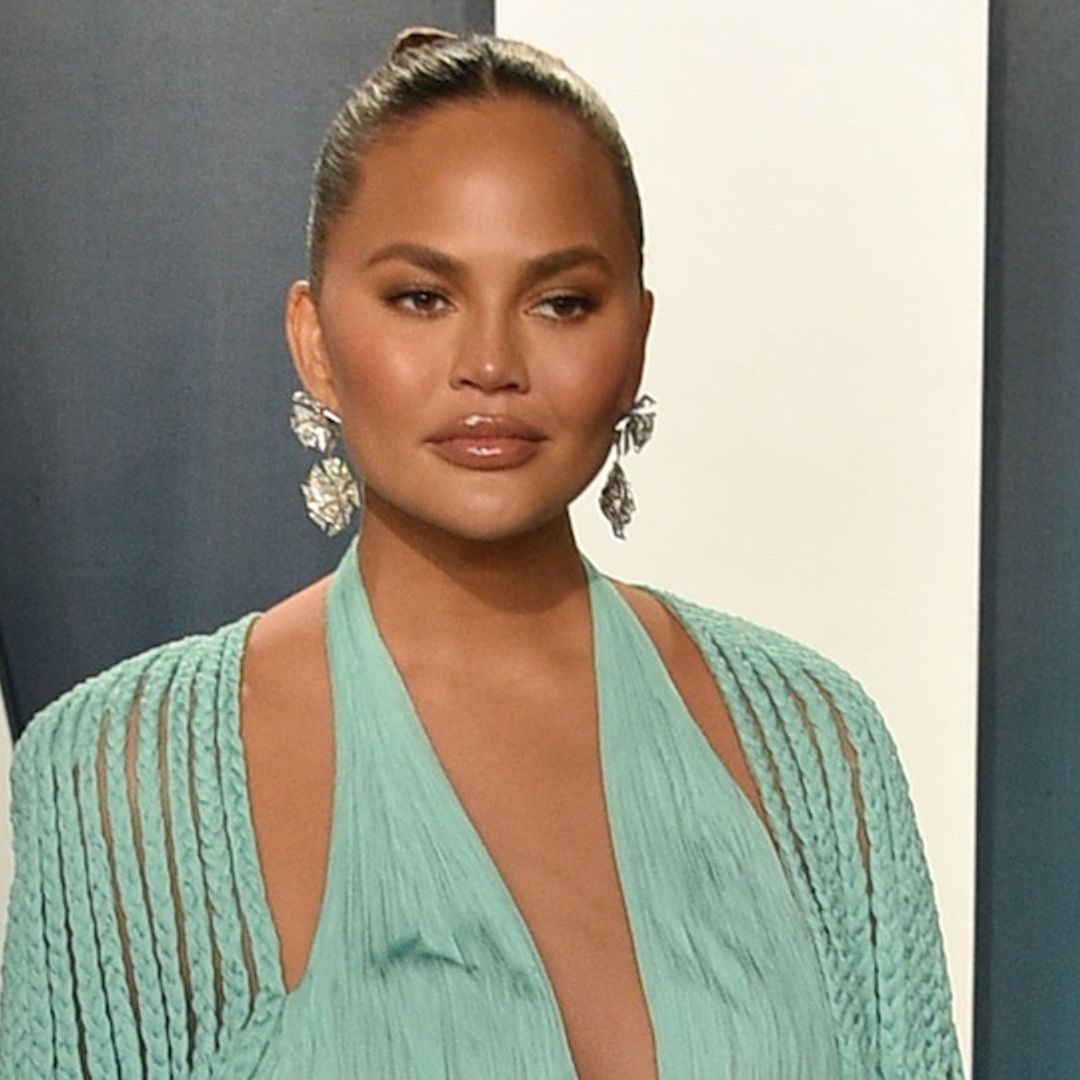 Chrissy Teigen hospitalized with 'scary' pregnancy complications