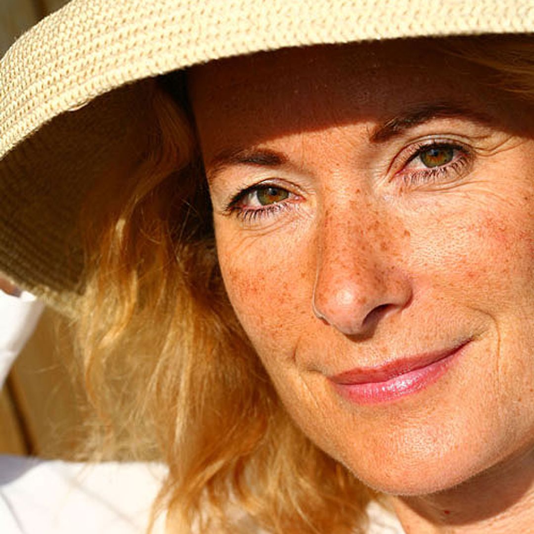 Liver spots and other pigmentation problems