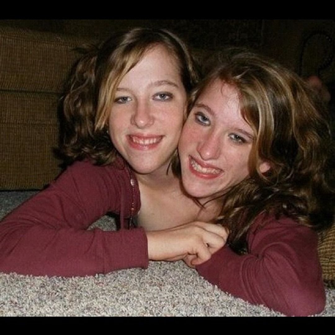 Conjoined twins Abby and Brittany Hensel talk challenge in personal life in unearthed interview