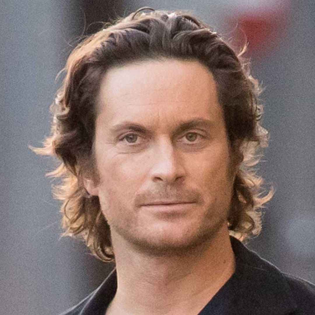 Oliver Hudson shares flare-up of upsetting condition