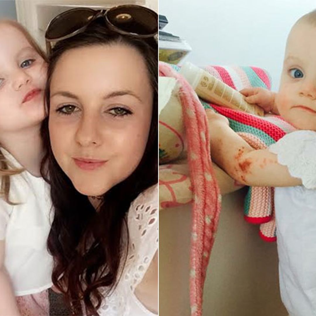 Mum praises miracle £3.99 cream which has cured her daughter's painful eczema