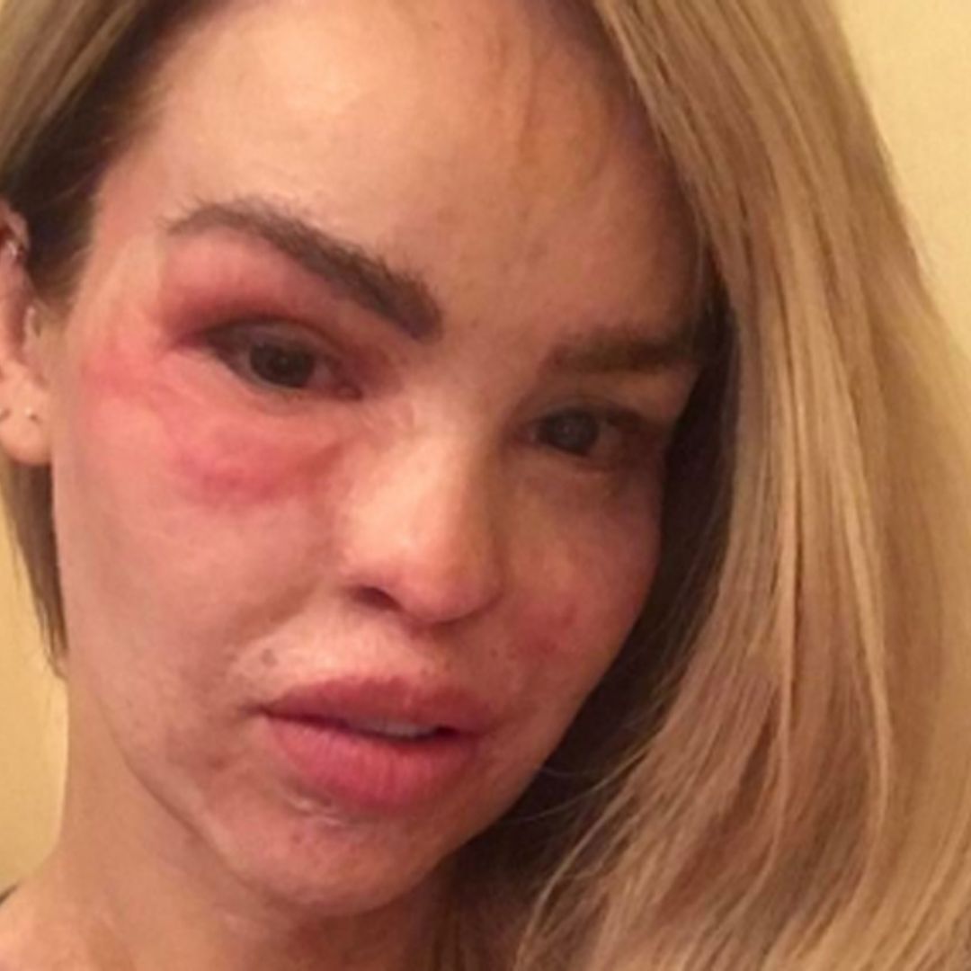 Katie Piper updates fans after being rushed to hospital on daughter's birthday
