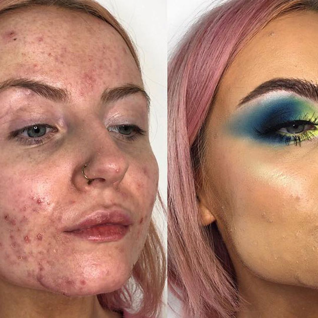 Acne sufferers are taking to Instagram to rave about this 'miracle' foundation