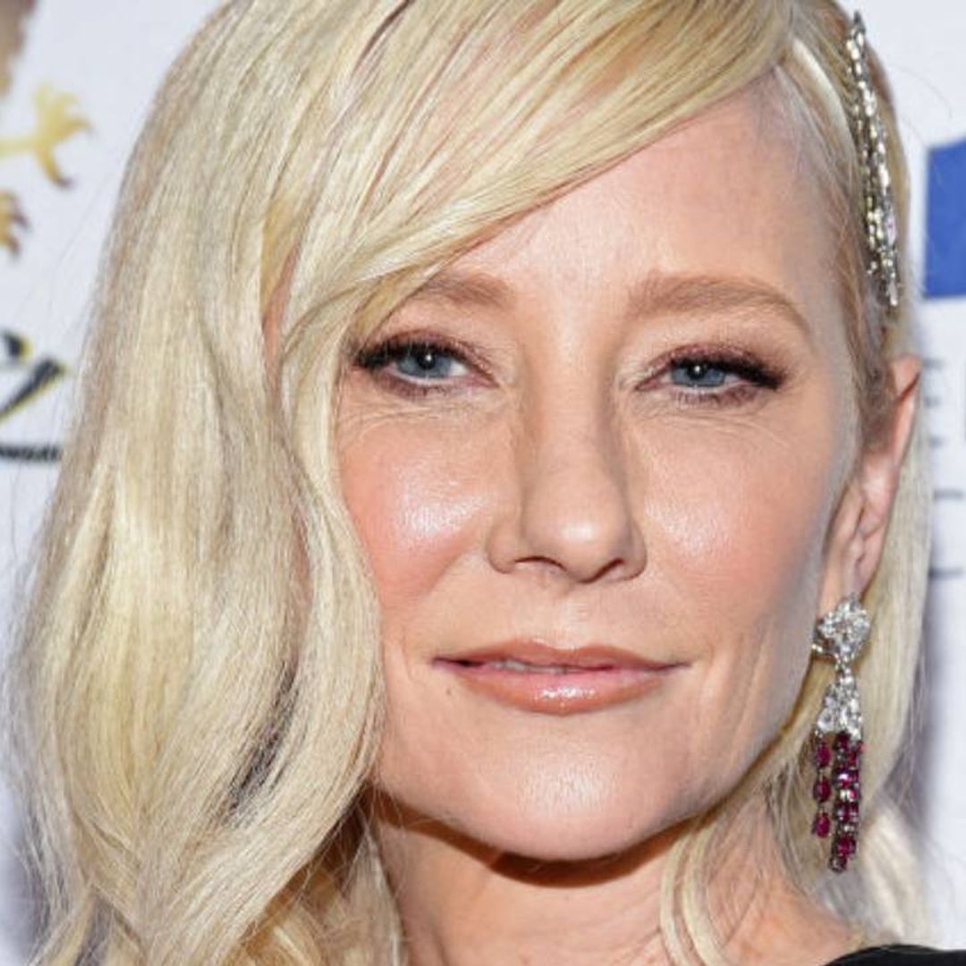 Anne Heche in critical condition following fiery car crash in Los Angeles