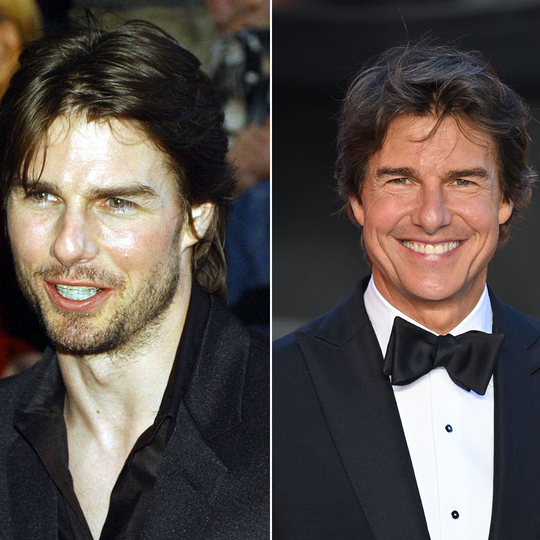 Tom Cruise's gleaming Hollywood smile transformation after 'rare' treatment