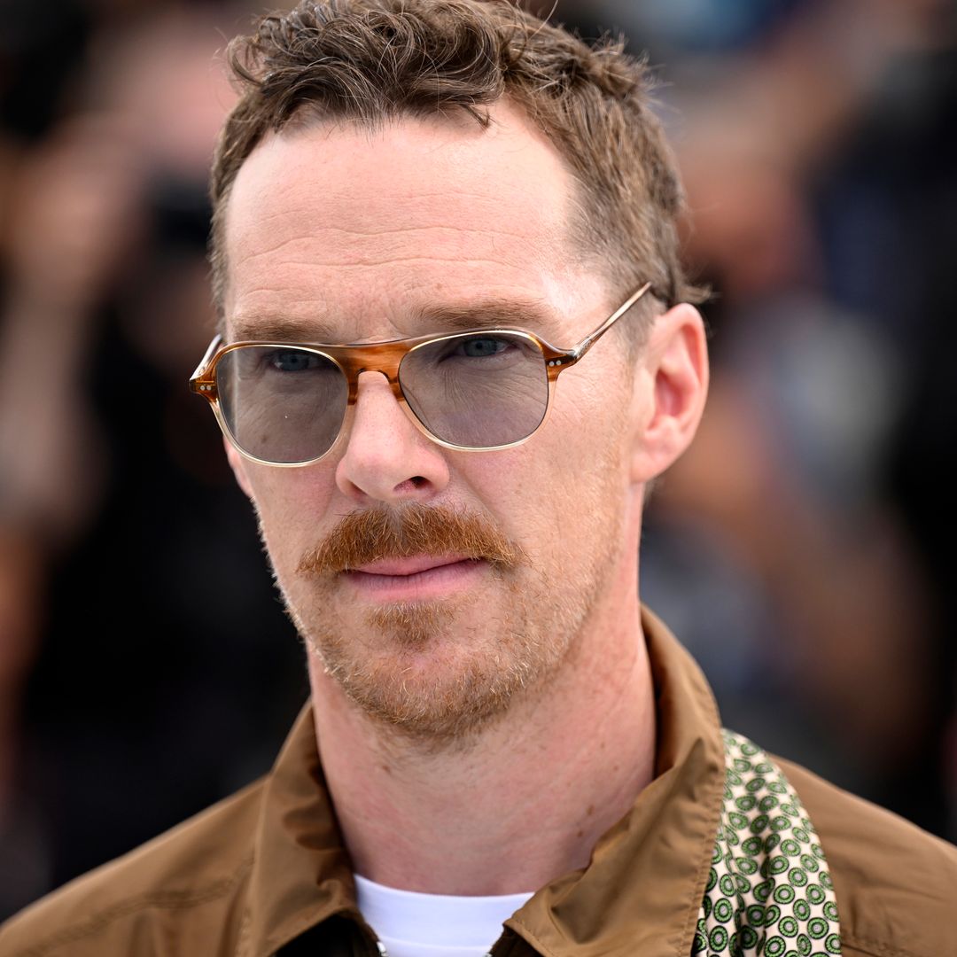 Benedict Cumberbatch issues surprise injury update