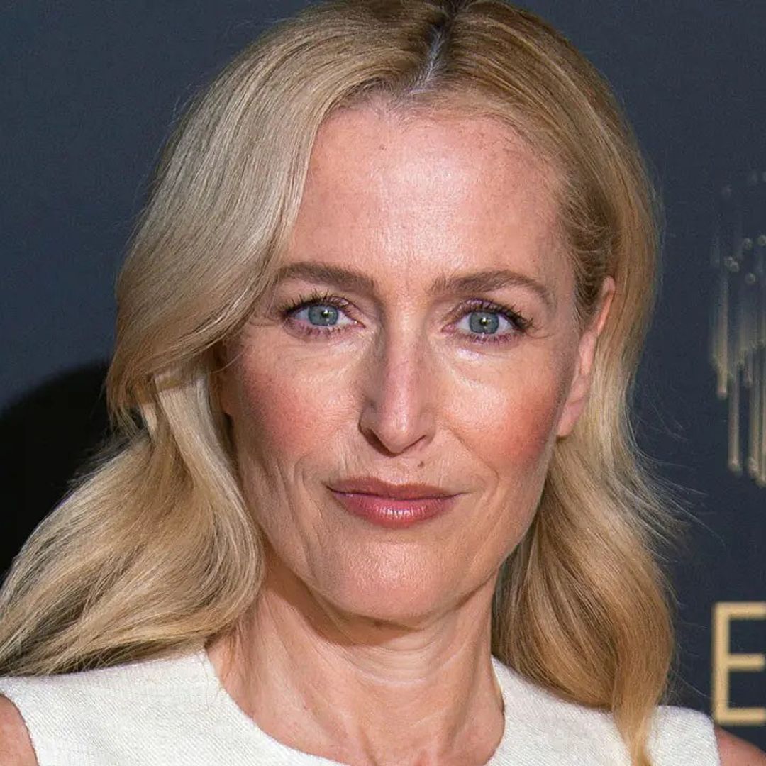 Gillian Anderson shows off bruised face in on-set snap