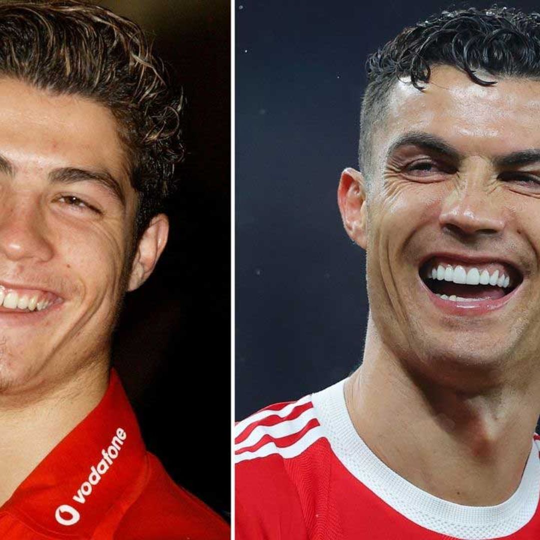 Cristiano Ronaldo smile transformation before and after: What has the footballer done to his teeth?