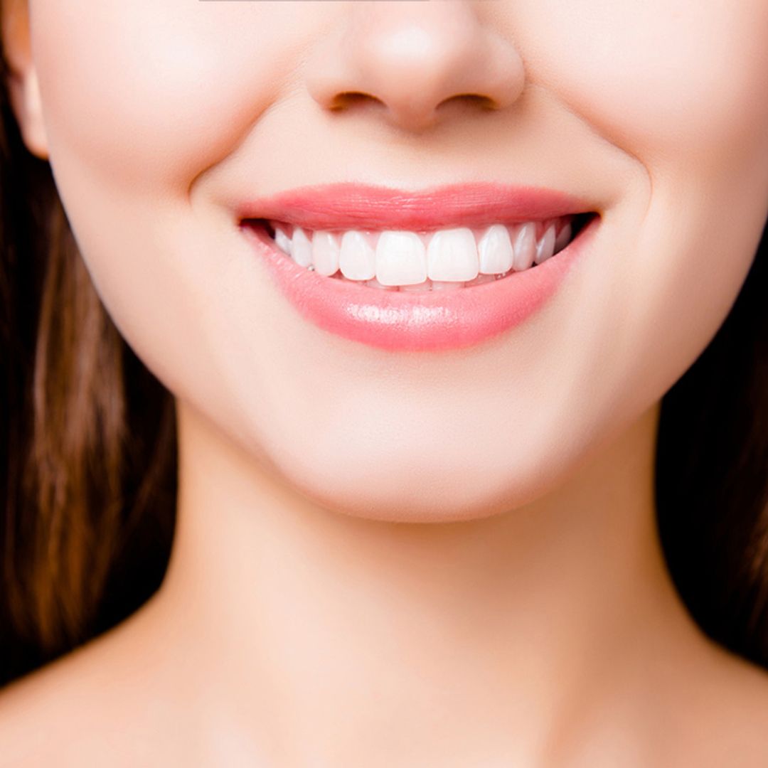 The do's and don'ts of teeth whitening