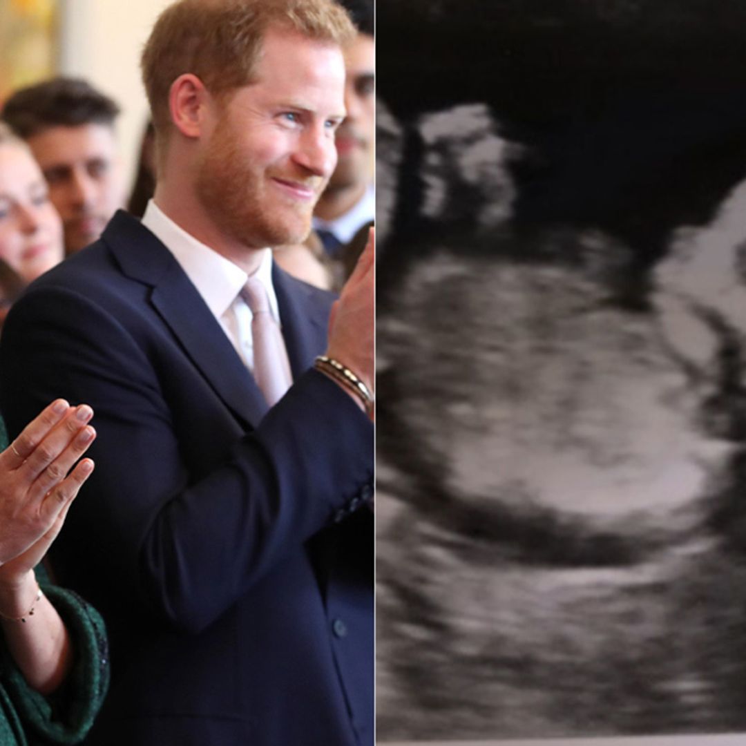 Meghan Markle and Prince Harry surprise with never-before-seen ultrasound photo