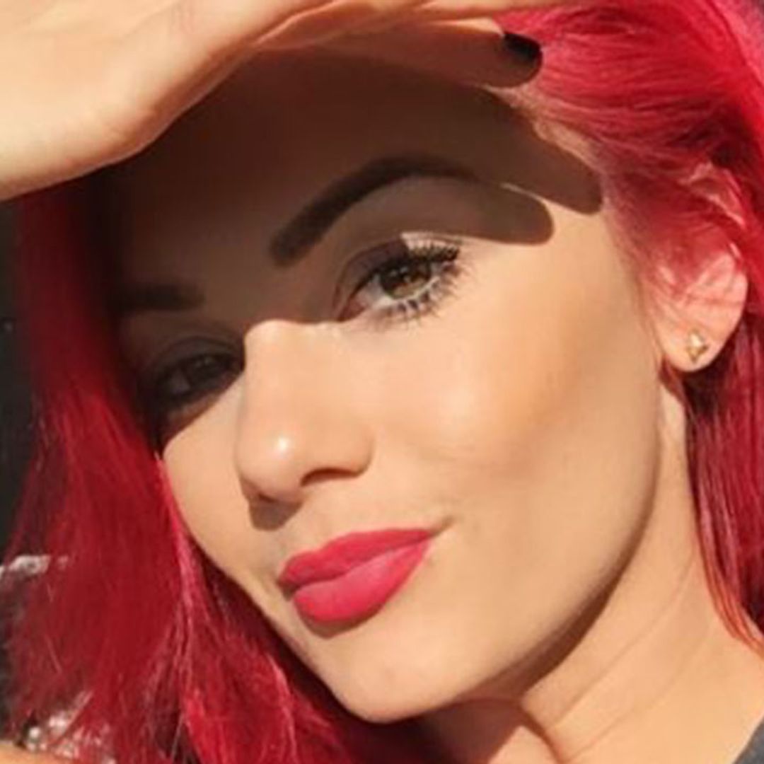 Strictly star Dianne Buswell reveals nasty injuries after embarrassing fall – watch video