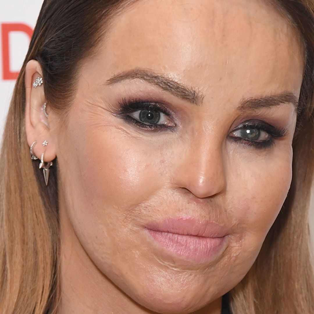 Katie Piper not leaving hospital 'any time soon' after ignoring bad infection