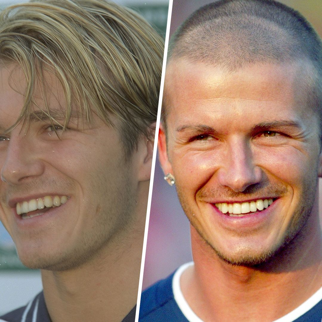 David Beckham's smile makeover: before and after photos