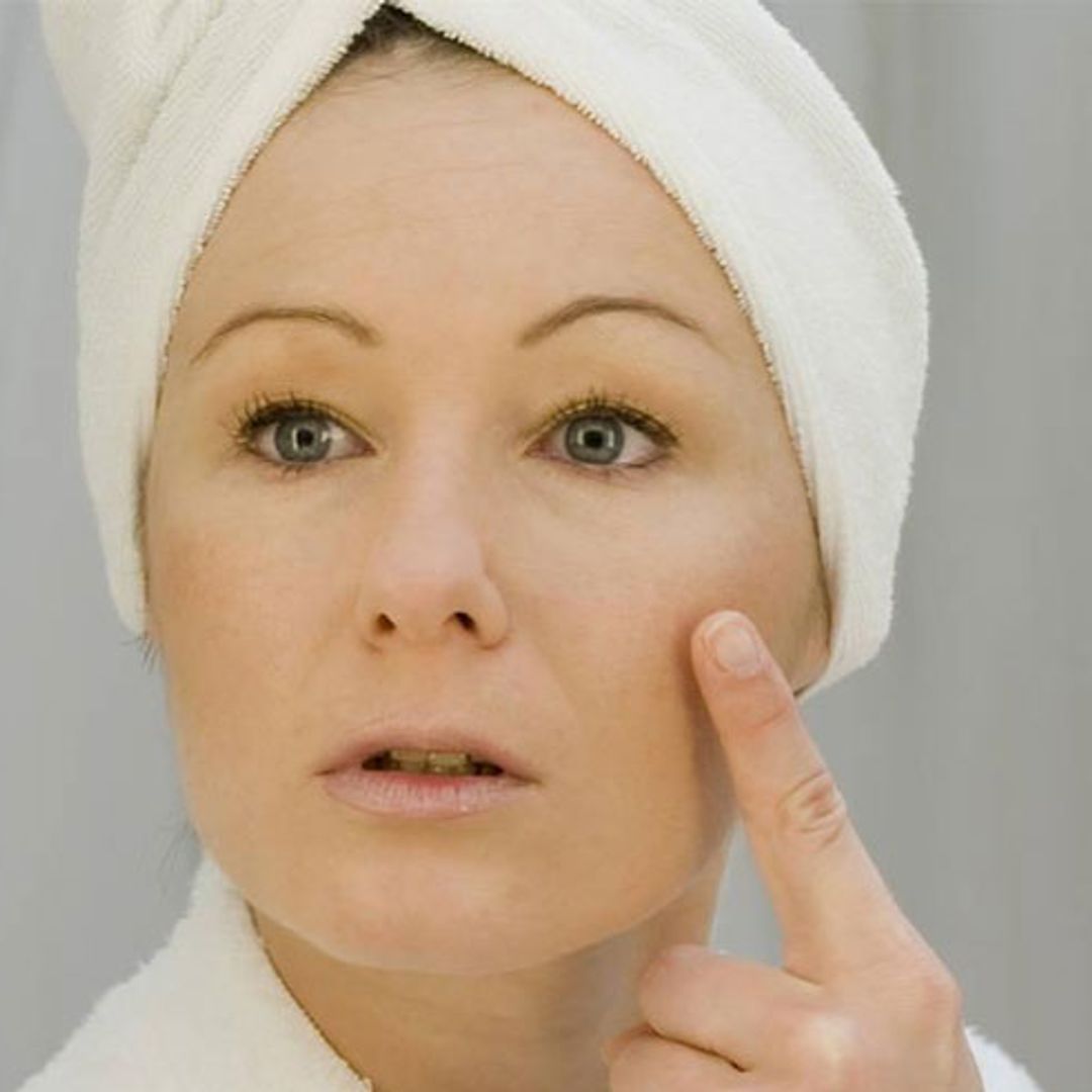 Keep skincare simple to battle rosacea