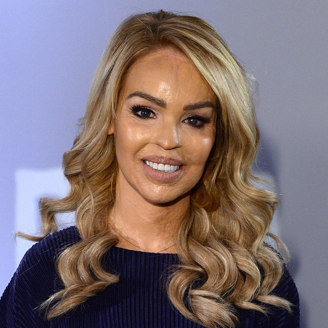 Katie Piper shares a harrowing photo of her burns: 'I was scared of people'