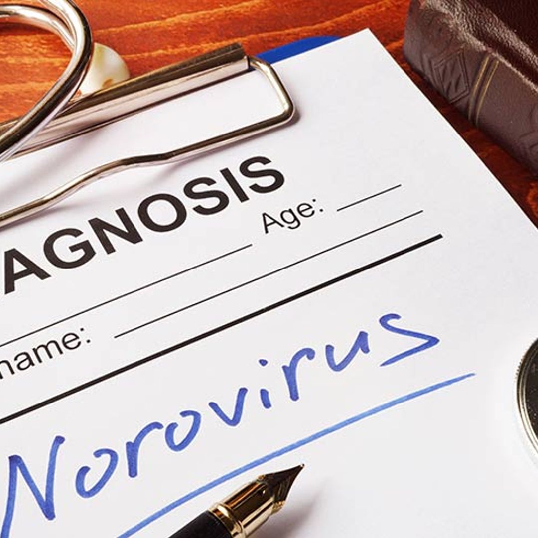 What are the symptoms and treatment for Norovirus?