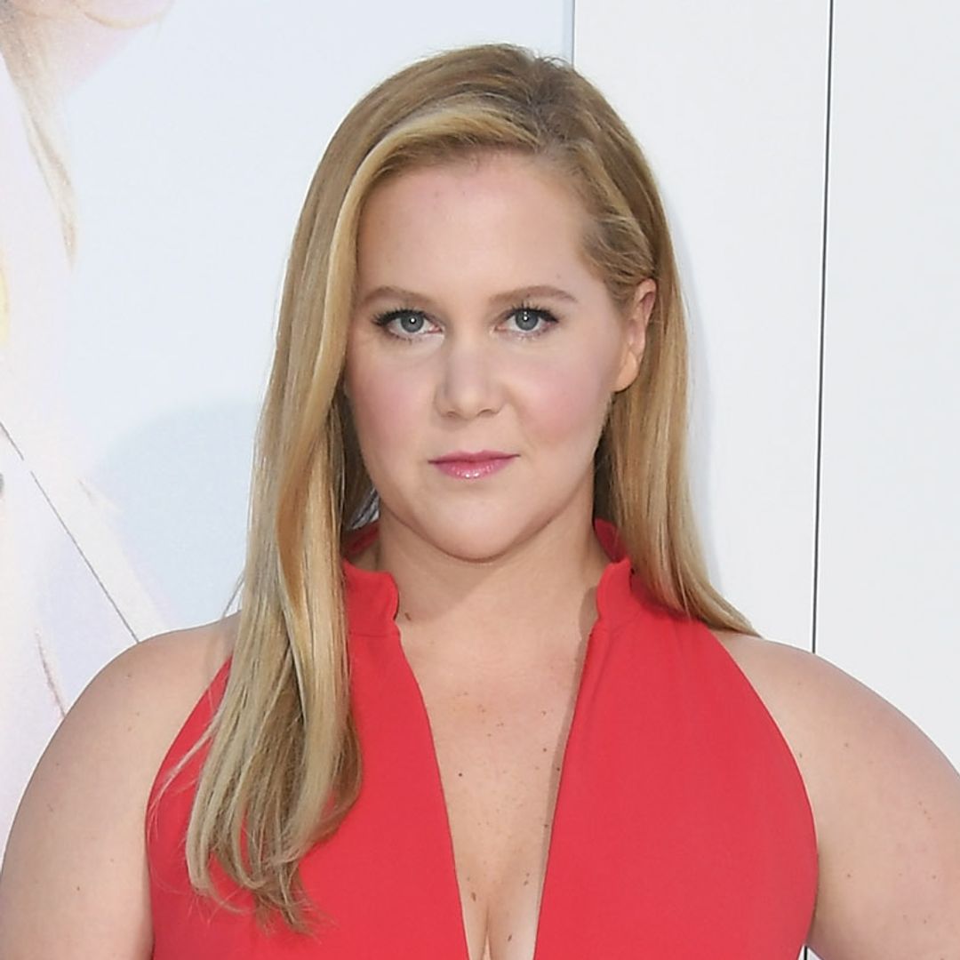 Amy Schumer opens up about her unexpected insecurity after getting liposuction