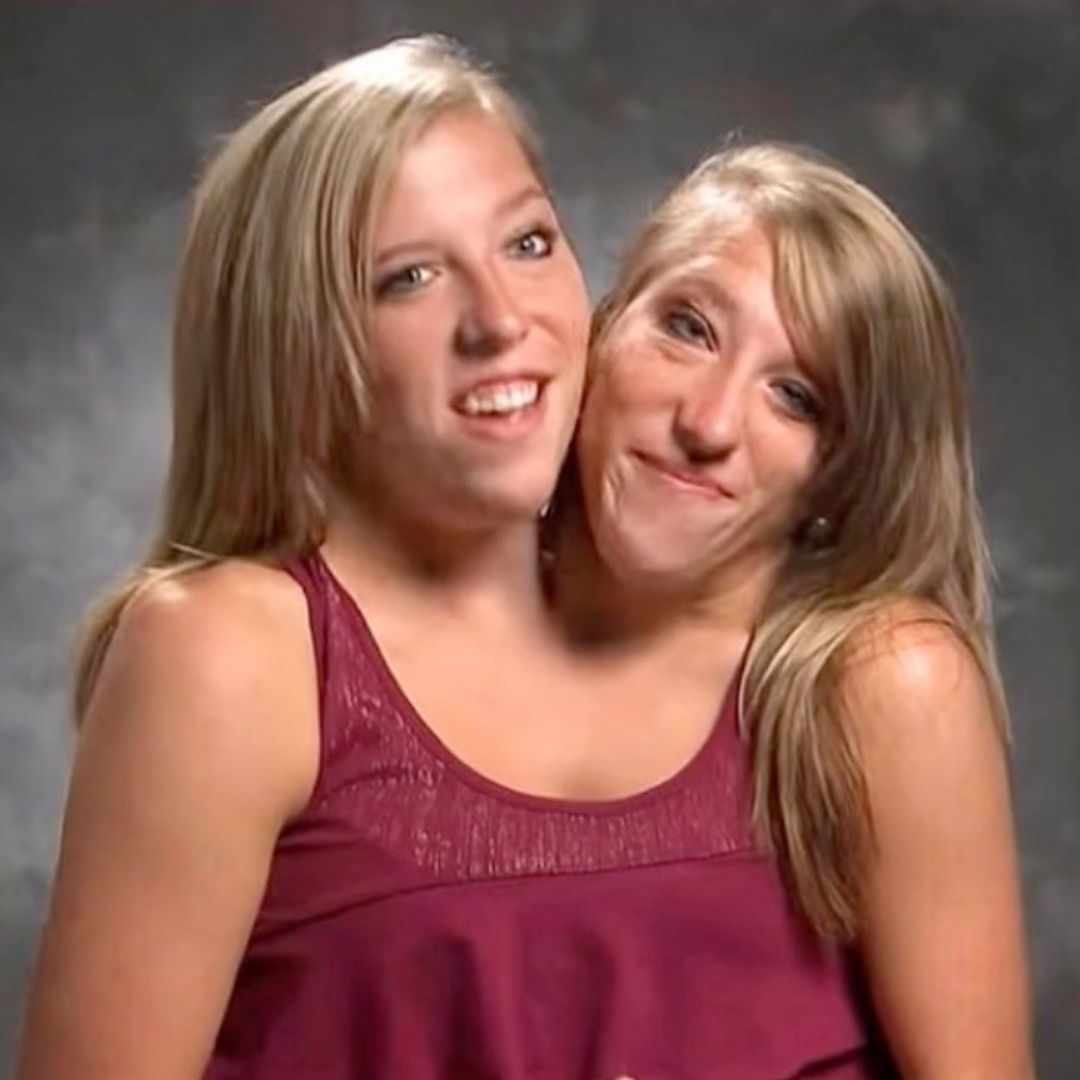 Conjoined twin Abby Hensel is married - see reality TV stars' wedding photos