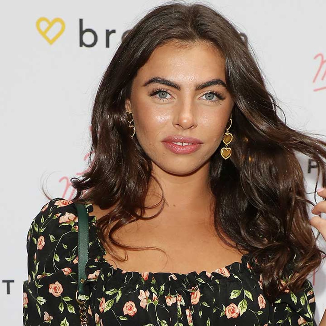 Love Island's Francesca Allen opens up about her acne scarring and sends an inspiring message to her fans