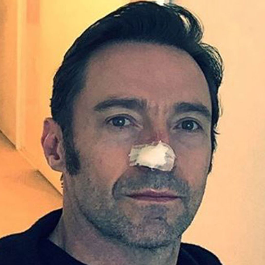 Hugh Jackman has another skin cancer growth removed from face