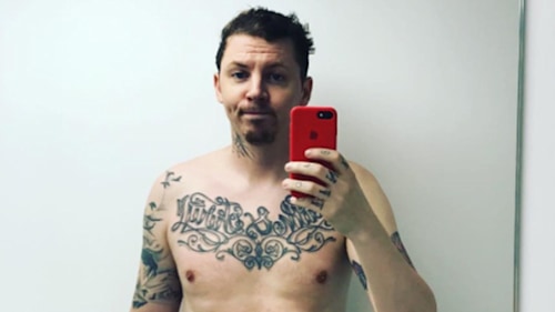 Professor Green posts shirtless photo after 'surgery gone wrong'